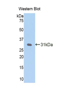 Polyclonal Antibody to C Reactive Protein (CRP)