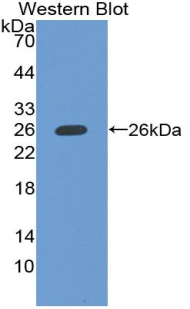 Polyclonal Antibody to C Reactive Protein (CRP)