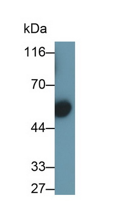 PAA829Hu01.jpg