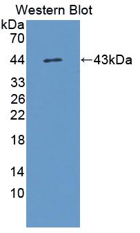 Polyclonal Antibody to Follicle Stimulating Hormone (FSH)