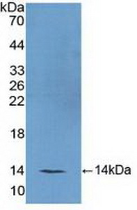 Polyclonal Antibody to Follicle Stimulating Hormone (FSH)