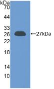 Polyclonal Antibody to Prolactin (PRL)