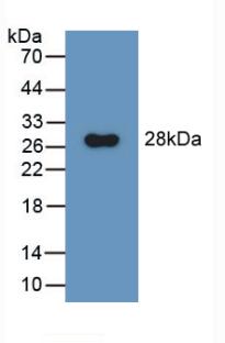 Polyclonal Antibody to Aminopeptidase A (ENPEP)