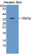 Polyclonal Antibody to Complement Component 3 (C3)