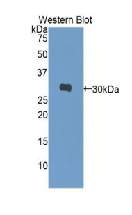 PAA875Hu01.jpg