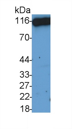 Polyclonal Antibody to Cluster Of Differentiation 26 (CD26)