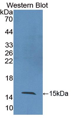 Polyclonal Antibody to Cluster Of Differentiation 26 (CD26)