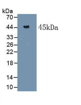 Polyclonal Antibody to Serum Amyloid A (SAA)