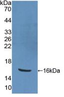 Polyclonal Antibody to Peroxisome Proliferator Activated Receptor Gamma (PPARg)