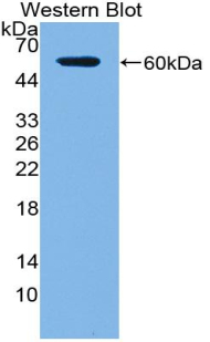 Polyclonal Antibody to Acid Phosphatase 5, Tartrate Resistant (ACP5)