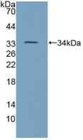 Polyclonal Antibody to Tumor Protein p53 (P53)