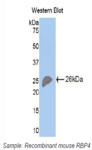 Polyclonal Antibody to Retinol Binding Protein 4 (RBP4)