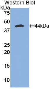 Polyclonal Antibody to Nephrin (NPHN)