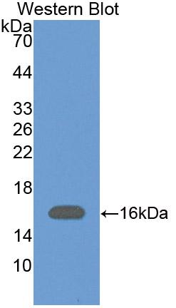 Polyclonal Antibody to Pre-B-Lymphocyte Gene 1 (VPREB1)