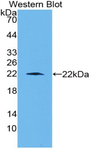 Polyclonal Antibody to Cluster Of Differentiation 6 (CD6)