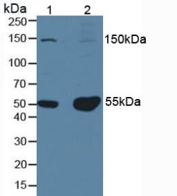 Polyclonal Antibody to Procollagen I N-Terminal Propeptide (PINP)