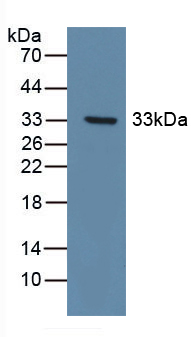 PAA977Hu01.jpg