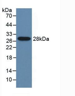 Polyclonal Antibody to Cytochrome P450 2E1 (CYP2E1)