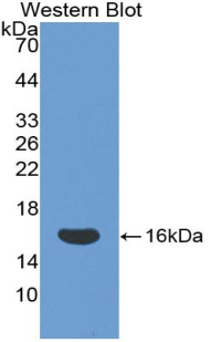 Polyclonal Antibody to Cluster Of Differentiation 160 (CD160)