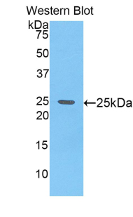 Polyclonal Antibody to Glypican 4 (GPC4)