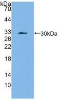 Polyclonal Antibody to Alpha-1-Antichymotrypsin (a1ACT)