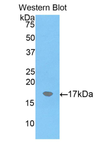 Polyclonal Antibody to Alpha-2-Macroglobulin (a2M)