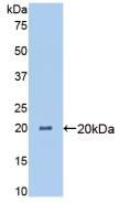 Polyclonal Antibody to Angiopoietin Like Protein 4 (ANGPTL4)