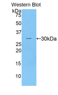 Polyclonal Antibody to Beta Catenin (β-catenin)