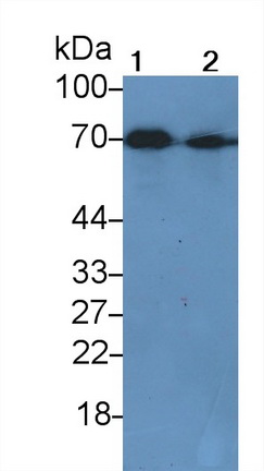 Polyclonal Antibody to Albumin (ALB)