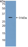 Polyclonal Antibody to Growth Hormone Receptor (GHR)