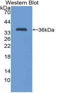 Polyclonal Antibody to Trefoil Factor 1 (TFF1)