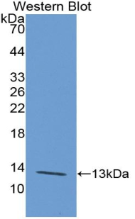 Polyclonal Antibody to Polymeric Immunoglobulin Receptor (PIGR)