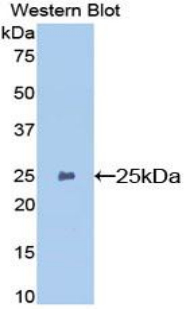 Polyclonal Antibody to Glutathione S Transferase Pi (GSTp)