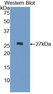 Polyclonal Antibody to Glutathione S Transferase Pi (GSTp)