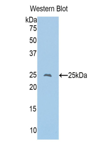 Polyclonal Antibody to Cluster Of Differentiation 8a (CD8a)