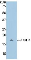 Polyclonal Antibody to Myosin Light Chain 1 (MYL1)