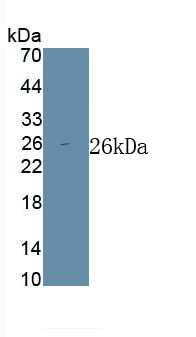 Polyclonal Antibody to Low Density Lipoprotein (LDL)