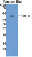 Polyclonal Antibody to Metallothionein 1 (MT1)