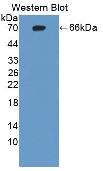 Polyclonal Antibody to Chondroitin Sulfate Proteoglycan 4 (CSPG4)