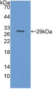 Polyclonal Antibody to Transferrin Receptor (TFR)