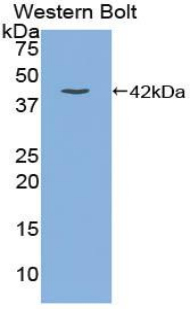 Polyclonal Antibody to Gastrin (GT)