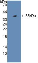 Polyclonal Antibody to Plasminogen (Plg)