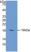 Polyclonal Antibody to Heart-type Fatty Acid Binding Protein (H-FABP)