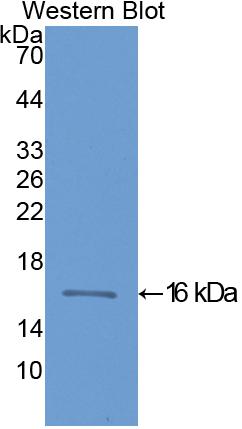 Polyclonal Antibody to Heart-type Fatty Acid Binding Protein (H-FABP)