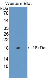 Polyclonal Antibody to Heart-type Fatty Acid Binding Protein (H-FABP)