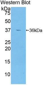 Polyclonal Antibody to Glutamate Decarboxylase 2 (GAD2)