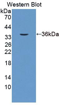 Polyclonal Antibody to Epithelial Cell Adhesion Molecule (EPCAM)