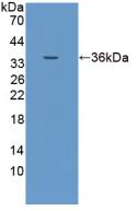 Polyclonal Antibody to Epithelial Cell Adhesion Molecule (EPCAM)