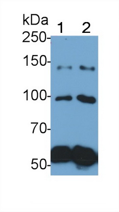 Polyclonal Antibody to Complement C4-B (C4B)