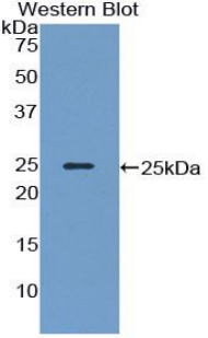 Polyclonal Antibody to Neurofilament 3 (NEF3)